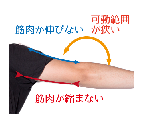 筋肉が十分に伸び縮みしなければ、可動範囲は狭くなる